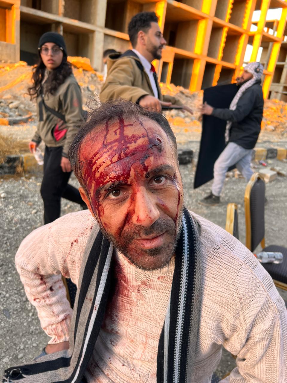 Close frontal outdoor portrait of a performer with red forehead and facial injury-like detail, pale stained sweater and scarf; crew/set context behind.