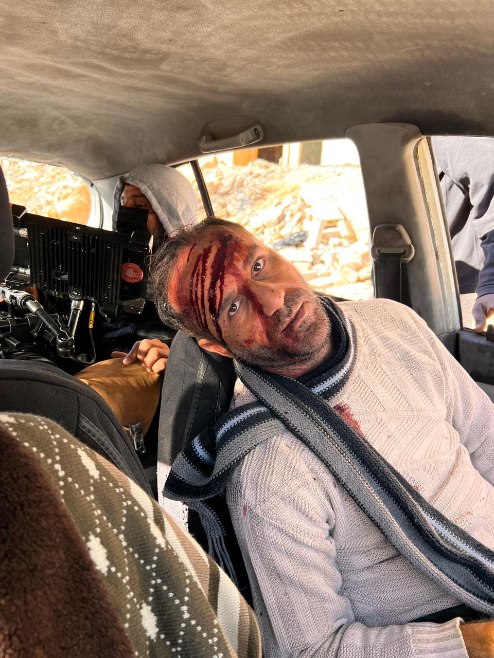 Performer seated in a car with red streaking across forehead, cheek and costume; production camera/equipment and another person visible behind.