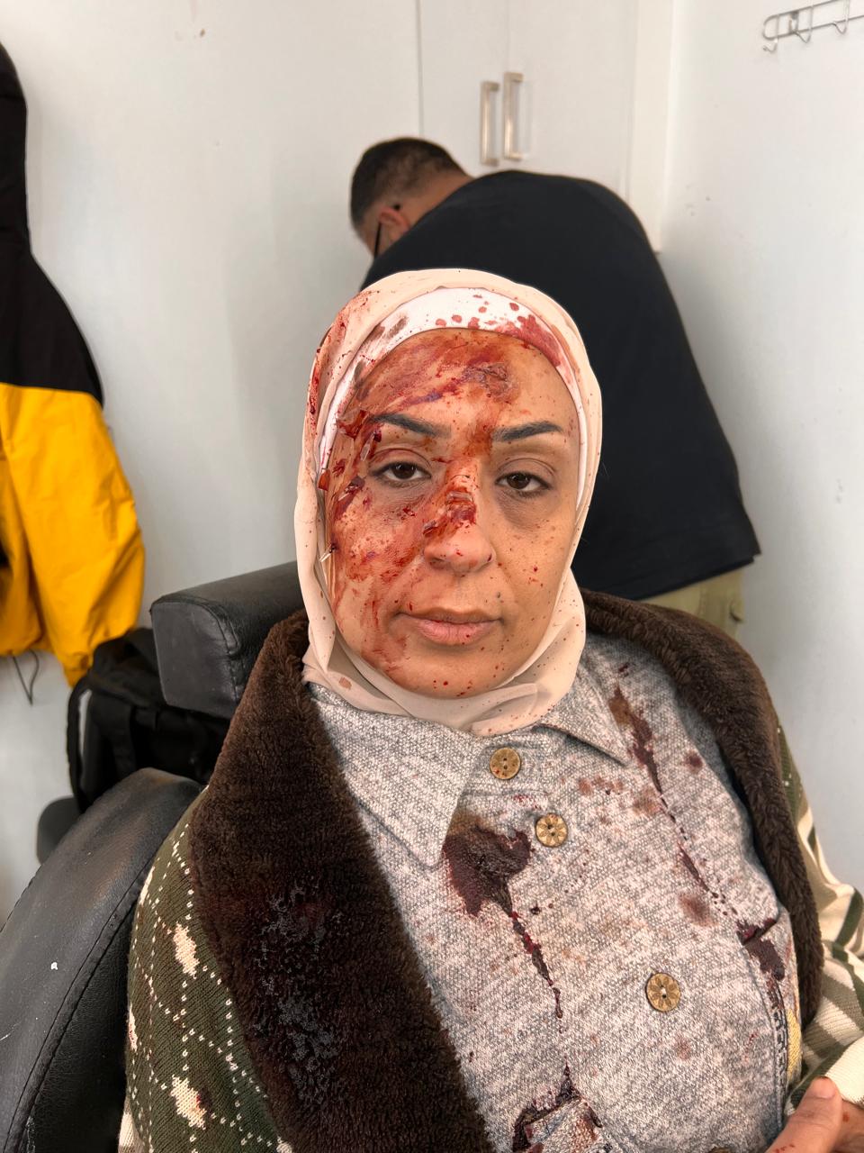 Seated performer in a pale head covering, gray buttoned garment and dark outer layer; red injury-like forehead/nose detail and extensive red staining on head covering and clothing.